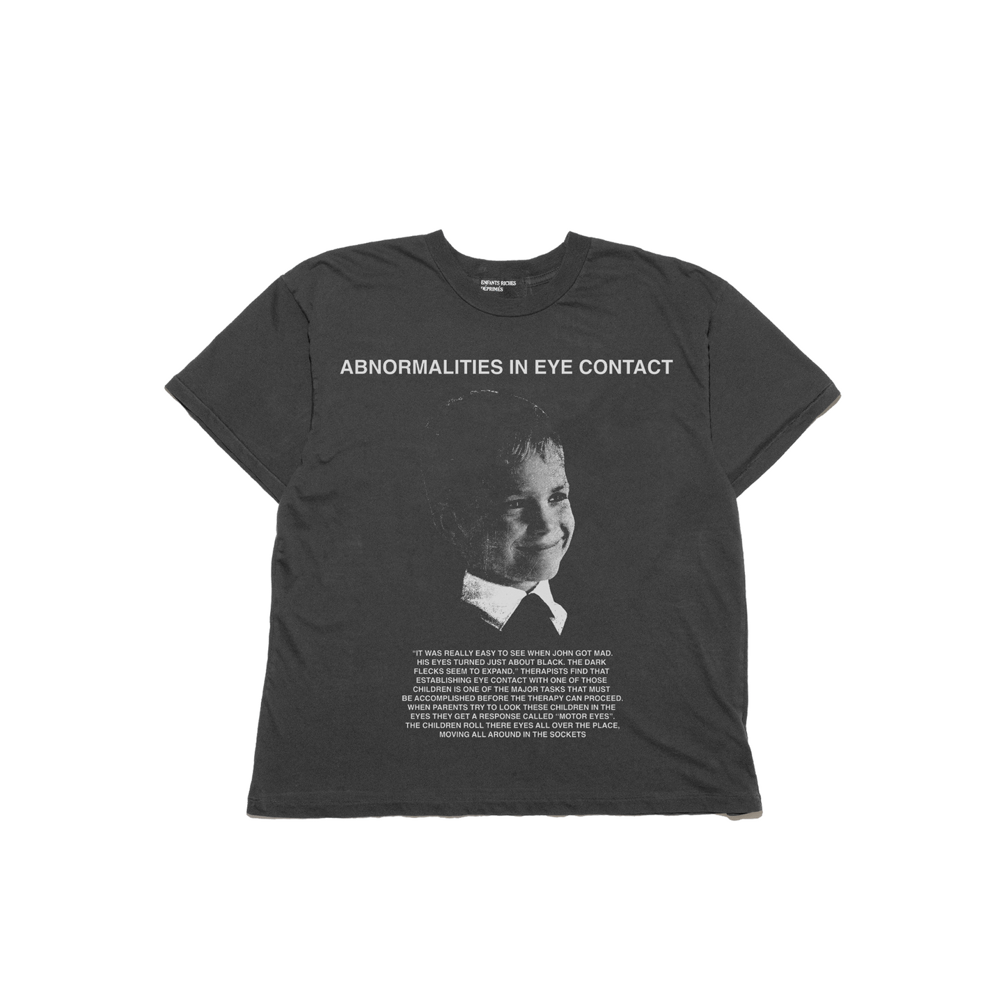 ABNORMALITIES IN EYE CONTACT T-SHIRT