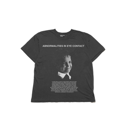 ABNORMALITIES IN EYE CONTACT T-SHIRT